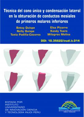 Imagen de portada del libro Técnica del cono único y condensación lateral en la obturación de conductos mesiales de primeros molares inferiores